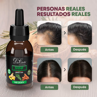 Don Cabello Loción Preventiva de Caida Reduce la Caída y Estimula su Crecimiento 125 Ml