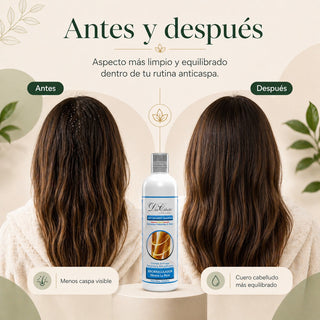 Don Cabello Champú Anticaspa, 500 ml