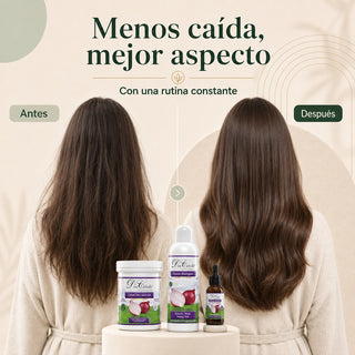 Pack Anticaída Intensivo Cebolla Roja – Caída Fuerte (Champú + Mascarilla + Loción) Don Cabello